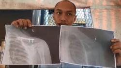 Heboh Siswa Kelas 3 SD di Jember Diduga Di-Smackdown Teman saat Ngaji hingga Lengan Patah