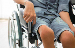 Benarkah Polio Bisa Sebabkan Kematian? Begini Penjelasan Ahli