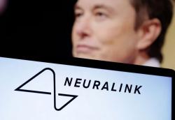 Wow! Elon Musk Sebut Manusia Bisa Gerakkan Mouse Komputer dengan Pikiran usai Ditanami Chip Otak