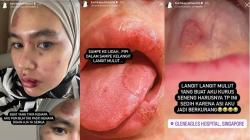 Kartika Putri Alami Luka-Luka di Wajah hingga Rongga Mulut: Doain Aja Ya