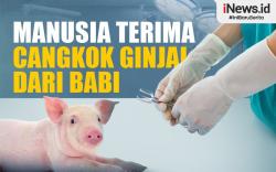 Infografis Manusia Terima Cangkok Ginjal dari Babi di AS, Pertama Kali dalam Sejarah!