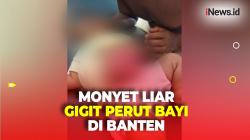 Bayi di Banten Diserang Monyet Liar, Perutnya Digigit hingga Usus Terburai