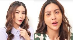 4 Potret Sarwendah Pamer Wajah usai Oplas di Korsel yang Tuai Banyak Komentar