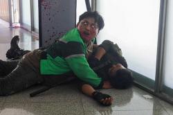 Penampakan Driver Ojol Berubah Wujud Setelah Digigit Penumpang LRT Jakarta