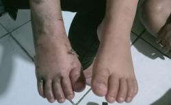 Polisi Pastikan Kaki Balita Terjepit Eskalator Mal di Bogor Murni Kecelakaan