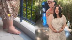 Kaki Istri Denny Sumargo Bengkak saat Hamil, Kenali Penyebab dan Cara Mengatasinya