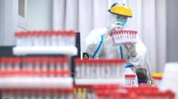 Mengenal Tes Genomic, Bisa Mengetahui 360 Masalah Kesehatan Dalam Sekali Swab