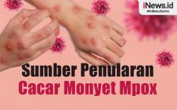 Infografis Gonta-ganti Pasangan dan Seks Sesama Jenis  Sumber Penularan Cacar Monyet Mpox