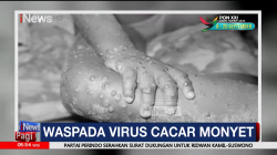 Virus Mpox Meningkat, Sandiaga Uno Minta Wisatawan Cek Kesehatan di Bandara