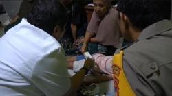 Ngeri! Bocah Perempuan di Makassar Luka-Luka Digigit Anjing saat Pulang Ngaji<