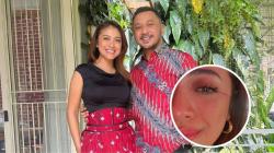 Tangis Haru Istri Pecah usai Giring Ganesha Jadi Wakil Menteri Kebudayaan: Kebanggaanku 