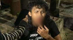 2 Demonstran Terluka saat Bentrok dengan Aparat Masih Dirawat di RS<