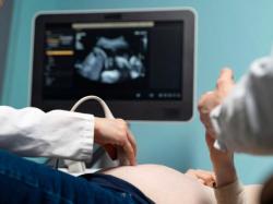 Hamil di Usia 35 Tahun? Dokter Sarankan Tes Diagnosis Prenatal, Ini Manfaatnya