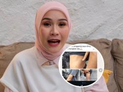 Viral ART Zaskia Adya Mecca Dianiaya Pria Mengaku Anggota, Leher dan Kepala Diinjak!