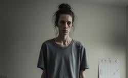 6 Dampak Berat Badan Turun Terlalu Cepat, Otot Ikut Hilang dan Risiko Batu Empedu