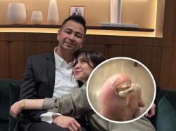 Raffi Ahmad Mendadak Posting Foto Mengerikan, Kuku Sultan Andara Patah!
