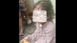 Pilu! Balita Perempuan di Surabaya Diduga Disiksa Paman dan Bibi, Kondisi Mengenaskan <