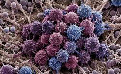 Kenapa Kanker Bisa Muncul Kembali Meski Sudah Dinyatakan Sembuh? Ini Penjelasannya