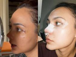 Rina Nose Ganti Nama usai Oplas Hidung? Ini Faktanya!