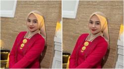 Wajah Ria Ricis Berubah, Netizen Tebak Oplas Hidung!