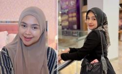 Demi Hidung Mancung, Ria Ricis Ngaku Rogoh Kocek hingga Ratusan Juta Rupiah
