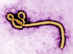 Apa Itu Virus Ebola Bundibugyo yang Ditetapkan WHO sebagai Darurat Global?