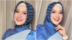 Bikin Pangling! Okie Agustina Diam-Diam Operasi Estetika di Korsel 