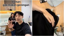Stop Makan Gorengan 40 Hari, Willie Salim Klaim Lemak Turun 5,8 Kg!