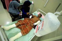 Begini Kondisi Korban Luka Bakar akibat Ledakan Sumur Minyak di Aceh Timur