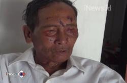 Penarik Becak Korban Pengeboman di Surabaya Dipulangkan ke Jombang