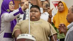 Obesitas, Bocah 7 Tahun Asal Karawang Ini Memiliki Berat Badan 101 Kg