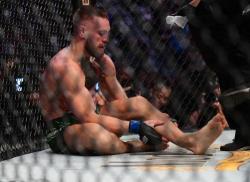 Kalah Lawan Dustin Poirier, Conor McGregor Alami Patah Engkel