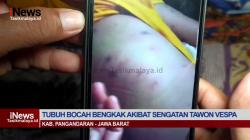 Video Bocah 11 Tahun Diserang Ratusan Tawon Vespa, Korban Alami Luka Sengatan Disekujur Tubuh