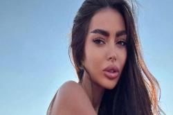 7 Kali Operasi Plastik Payudara dan Bokong, Model Ini Ingin Terlihat Seperti Kim Kardashian