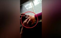 Cincin Nyangkut di Jari Manis Terpaksa Dipotong...Iih Gergajinya Nyaris Kena Tangan