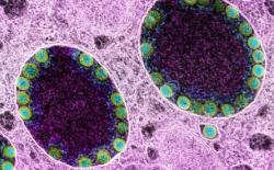 Muncul Varian Baru XE yang 10 Persen Lebih Menular dari Omicron, Begini Gejalanya