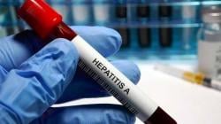 Antisipasi Hepatitis Akut, Dinkes Kota Bandung Imbau Masyarakat Terapkan Ini