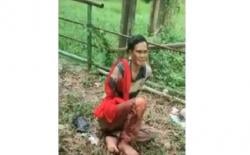 Tangan Kanan Pengunjung Sinka Zoo Putus Diserang Buaya