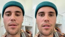 Justin Bieber Menderita Sindrom Ramsay Hunt, Apakah Sangat Berbahaya?