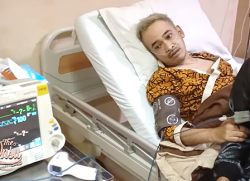 Ternyata Ini Penyakit Ruben Onsu, Harus Lakukan Transfusi Darah Sampai Masuk ICU