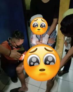 Bikin Ngilu, Mr. P Orang Ini Bengkak Terjepit Gantungan Kunci