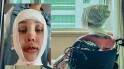 Lucinta Luna Operasi Pemotongan di Bagian Leher untuk Hilangkan Suara Laki-laki, Begini Kondisinya