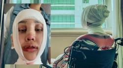 Lucinta Luna Akui Susah Menelan Makanan usai Operasi Pemotongan di Bagian Leher
