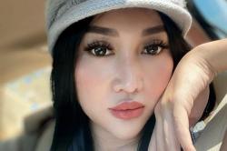 Lucinta Luna Bocorkan Raut Wajah Cantik usai Operasi, Mirip Jisoo BLACKPINK?