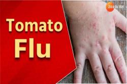 Waduh! Covid-19 dan Cacar Monyet Belum Hilang, Kini Muncul Flu Tomat