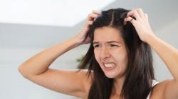 Miliki Ketombe Rambut? Begini 4 Tips Hilangkan Ketombe Pakai Bahan Alami