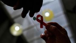 Geger 407 Mahasiswa Bandung Disebut Idap HIV, Kemenkes: Akumulasi Sejak 1991