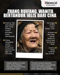 Infografis: Kisah Zhang Ruifang, Manusia Bertanduk Asal China