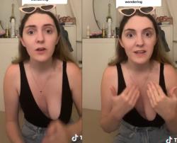 Payudara Perempuan Cantik Ini Hanya Tumbuh Sebelah, Cerita Penyakit Langka Ini Viral