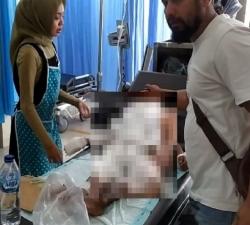 Ya Ampun! Tersiram Minyak Panas Bocah 5 Tahun Alami Luka Bakar Seluruh Tubuhnya